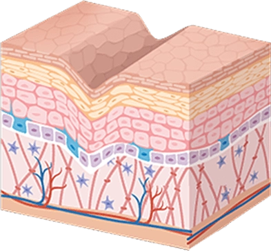CaviArgan-Cream-Prod-Before