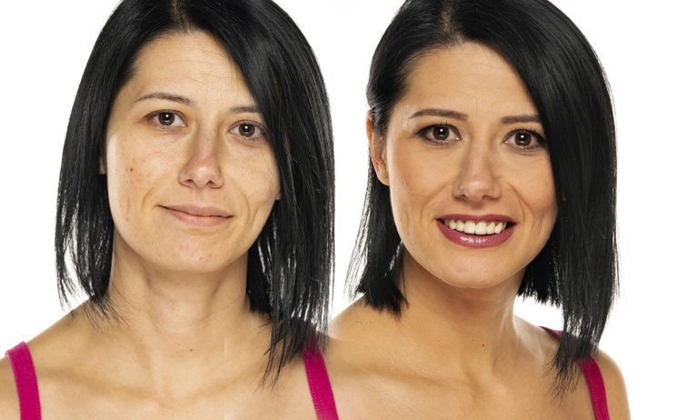 complexion-Before-After