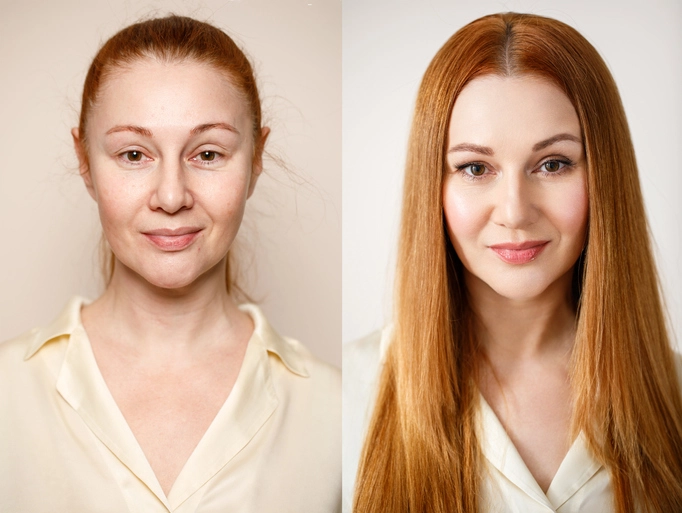 radiance-Before-After